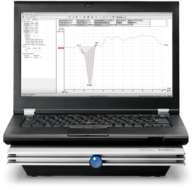 xeclipse_ep25_800x800